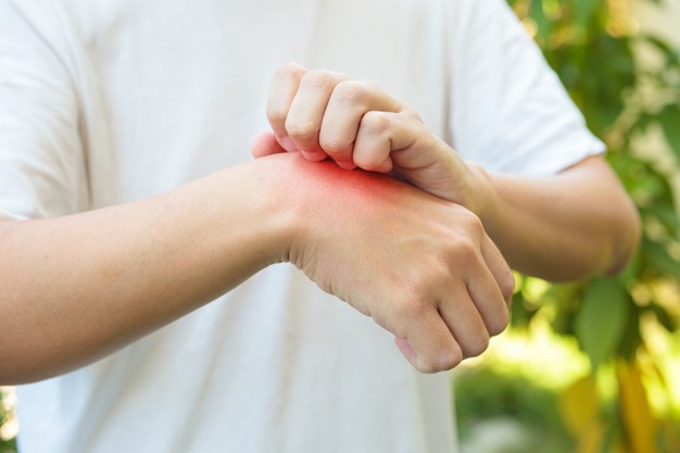 man-itching-scratching-hand-from-allergy-skin-rash-cause-by-insect-bite-outdoor_293060-2597